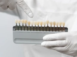 Fatete dentare Buzau clinica JoliDent