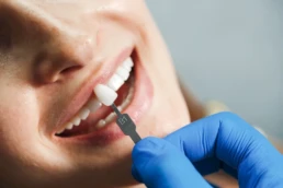 Restaurare dentara clinica Jolident: &zwnj;Obturatia din compozit, fatete de portelan, coroana dentara din ceramica