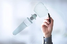 Implant dentar la JoliDent Buzau