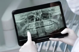 Radiografie dentara digitala