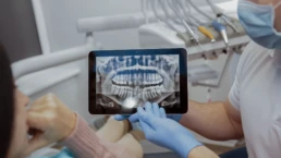Ce pot dezvălui radiografiile dentare