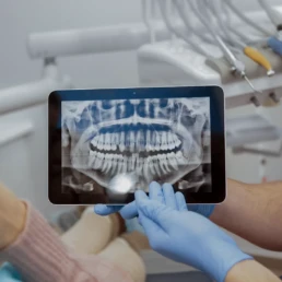 Ce pot dezvălui radiografiile dentare