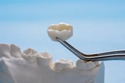 coroane dentare la JoliDent